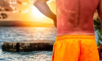 Bruciore da sole ed eritema cinque rimedi naturali per alleviare il bruciore