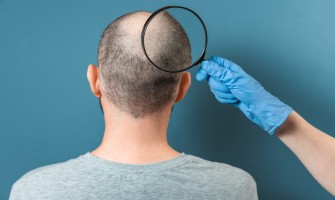 Capelli che cadono? i migliori rimedi naturali per rinforzarli