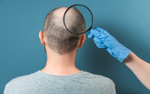 Capelli che cadono? i migliori rimedi naturali per rinforzarli