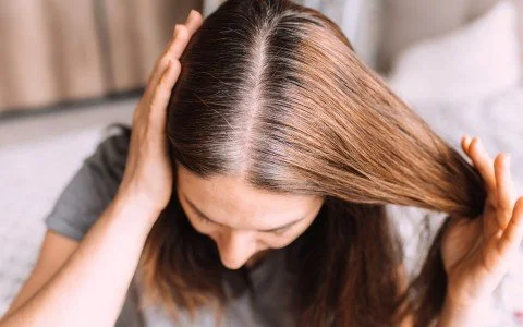 Rimedi naturali per capelli grassi: la tua guida definitiva Rimedi naturali per capelli grassi: la tua guida definitiva