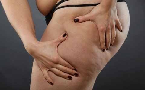 Come combattere la cellulite